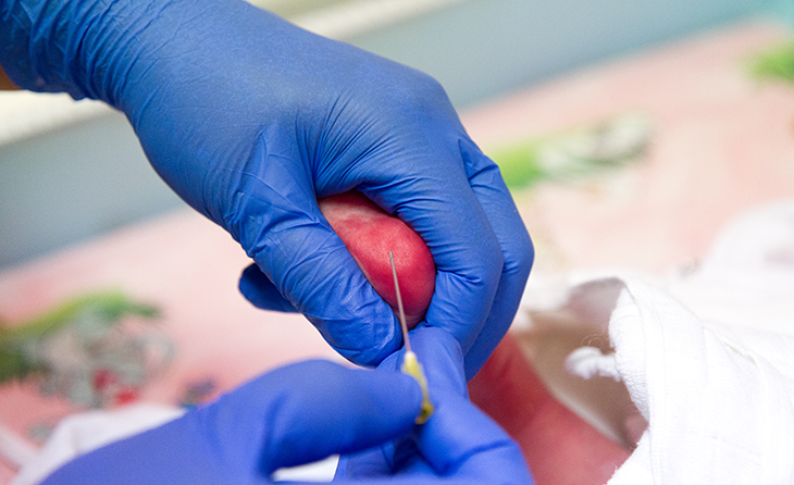 Topuk Kanı Taraması